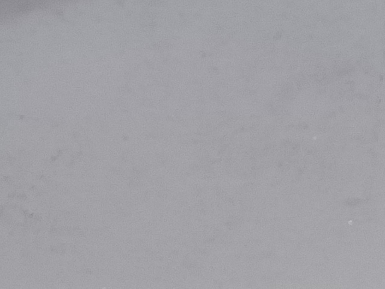 右した辺りに、チリあります。