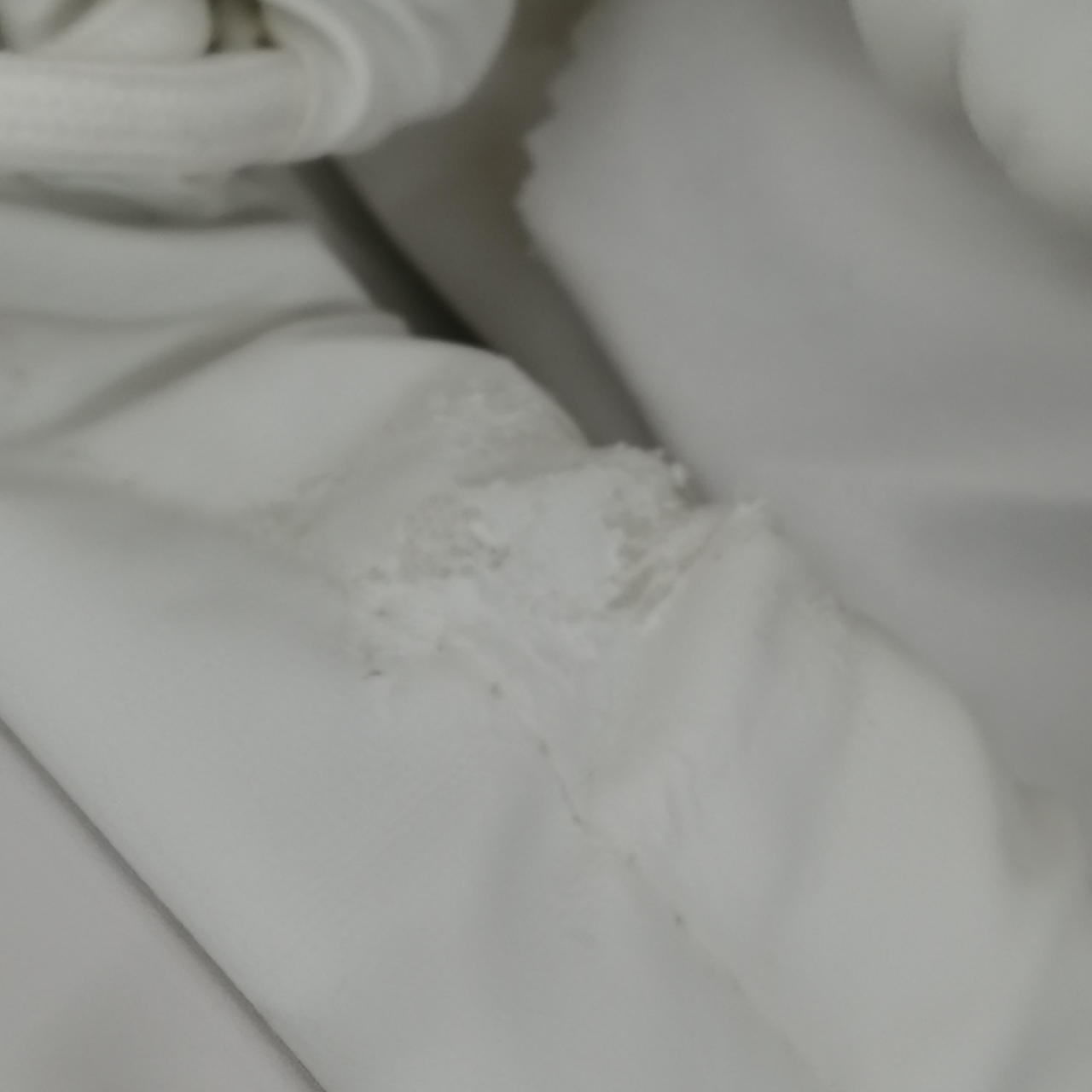 収納ケースに劣化がみられます。