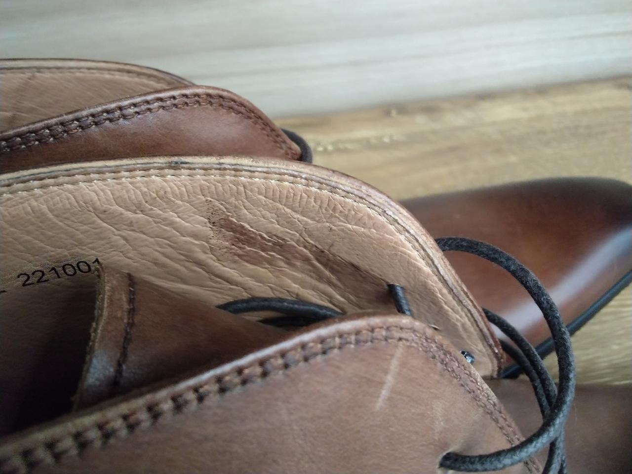 右足内側に変色あり