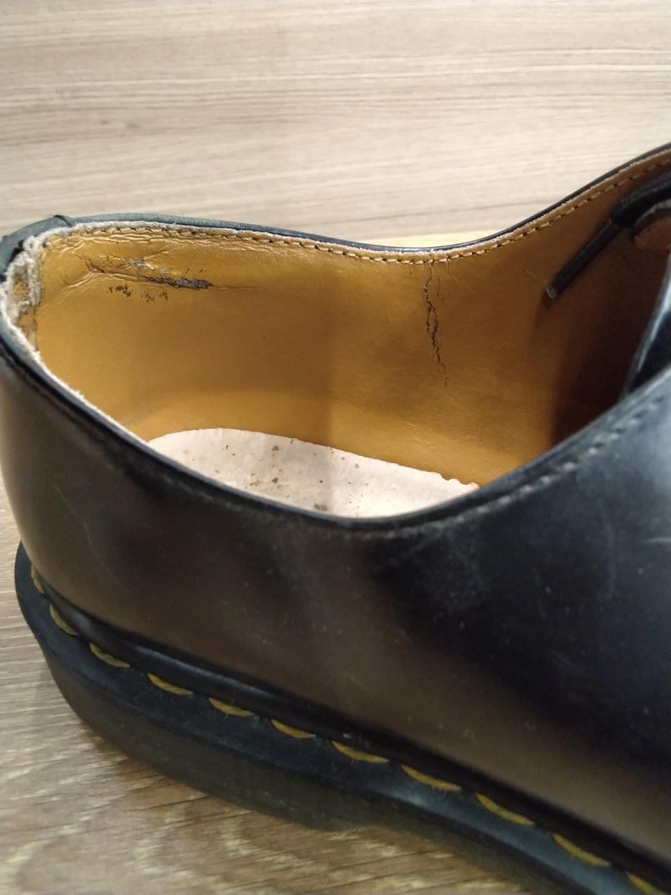 右足内側擦れあり