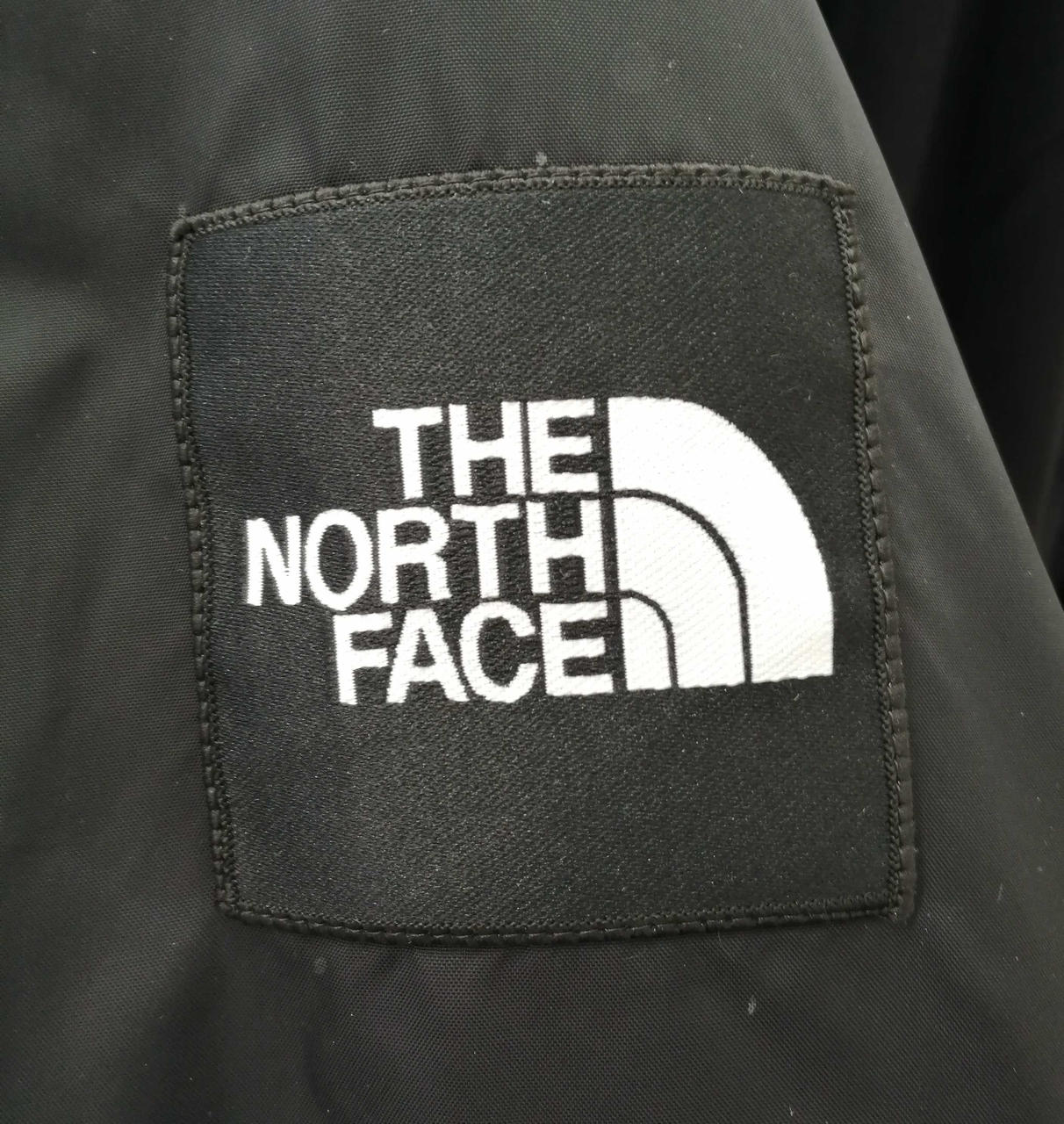 左の腕あります