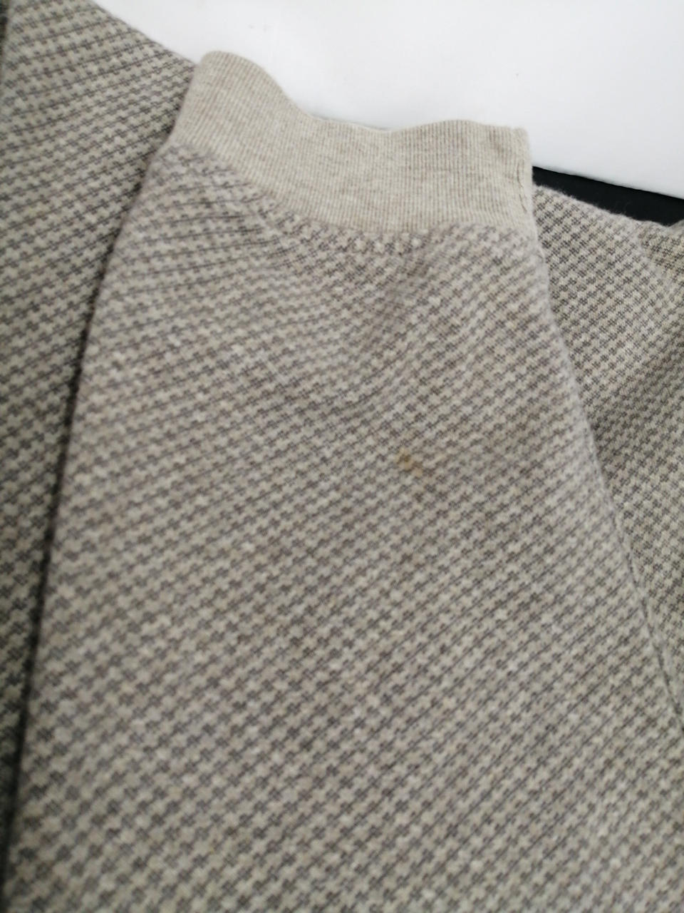 左の手首に汚れあります