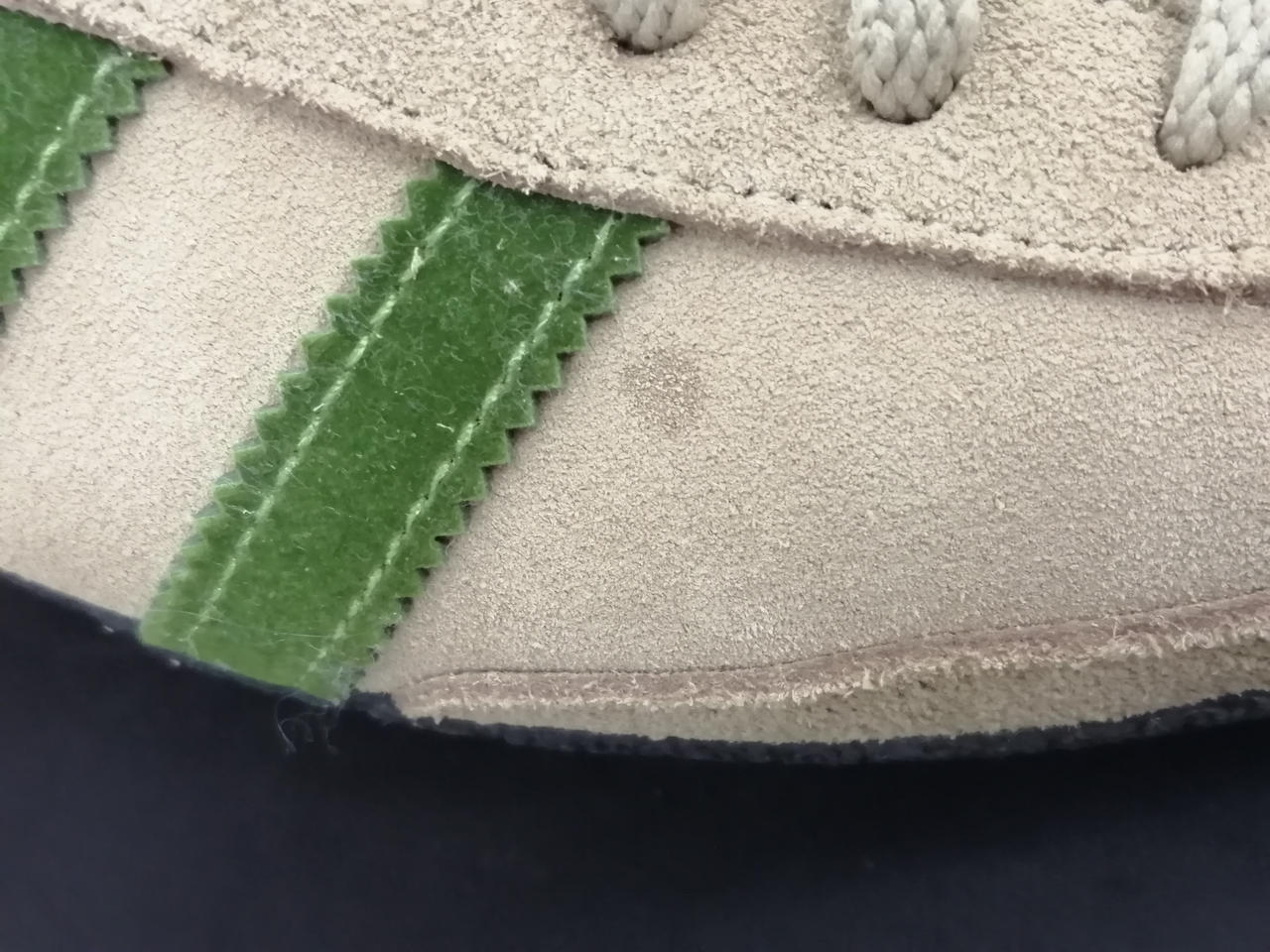 右足の外側にシミあります