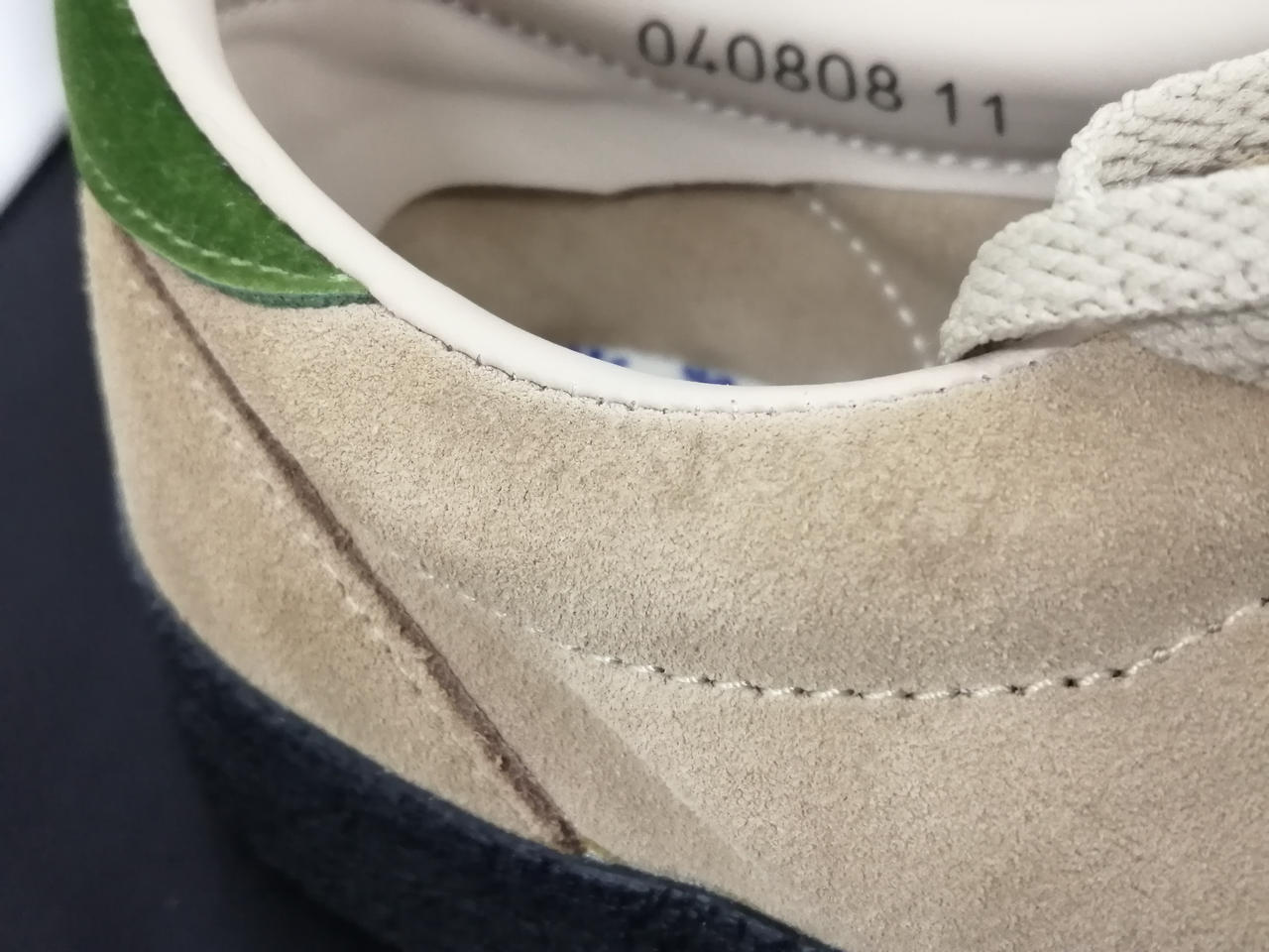 右足シミあります