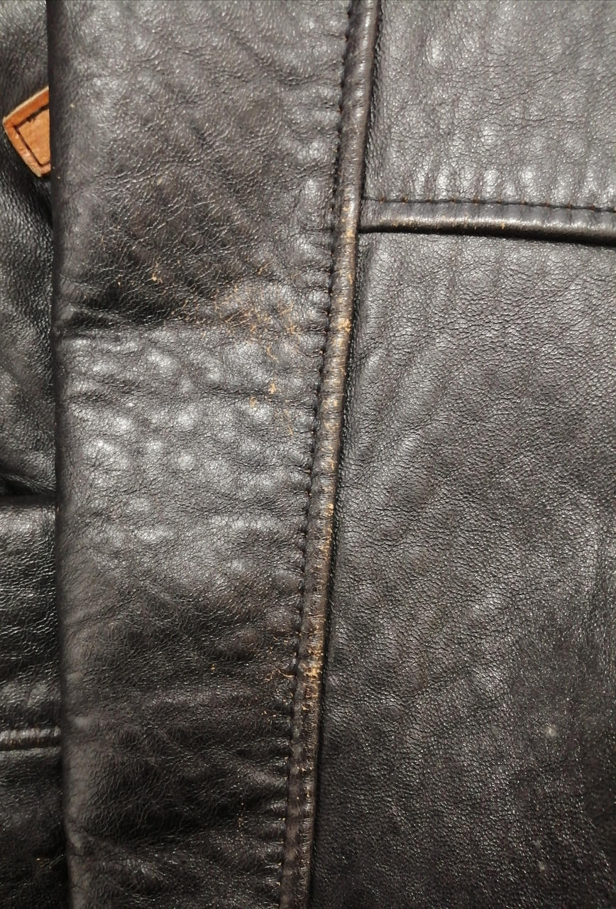 左腕側剥がれあります