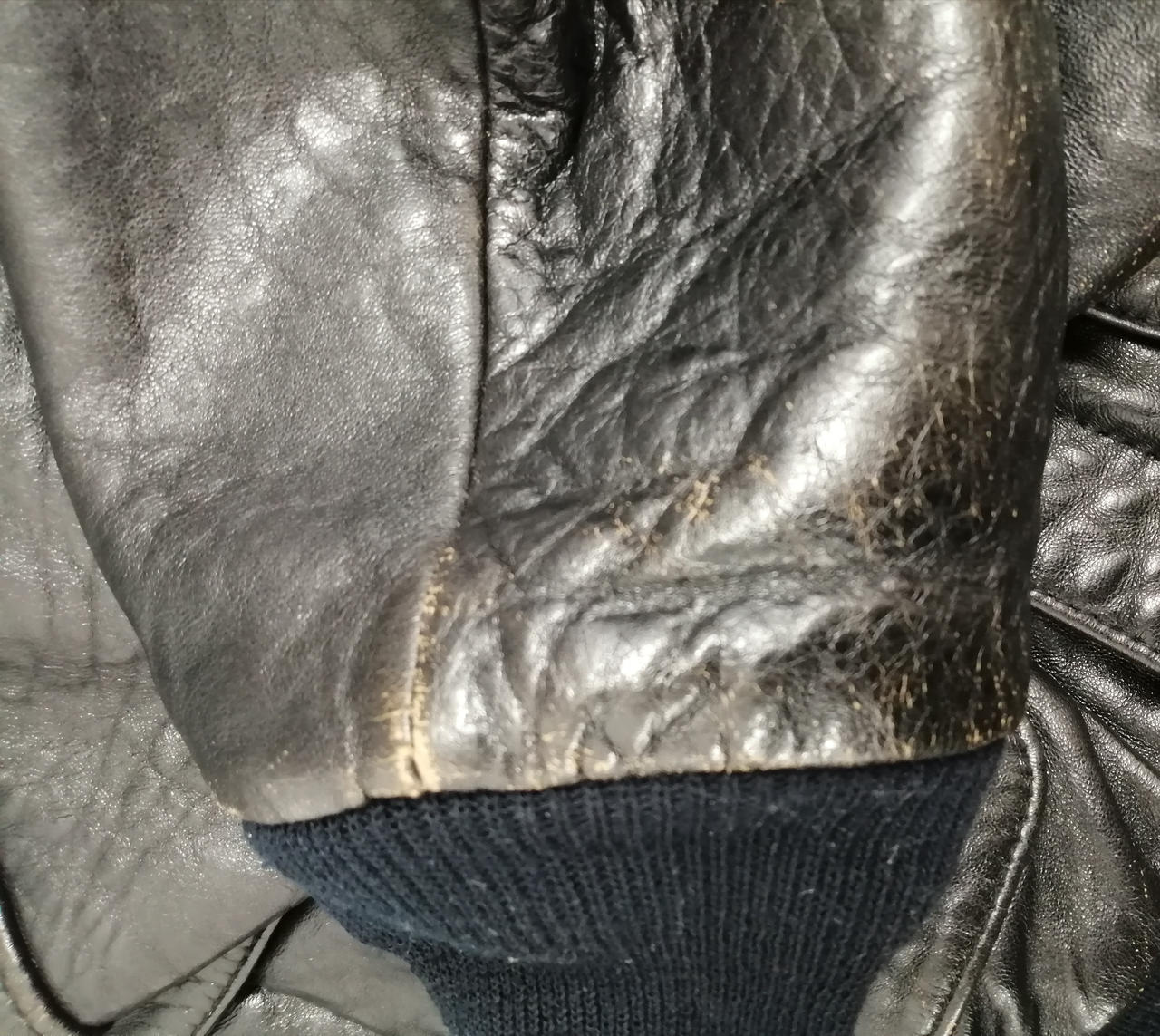 左手首剥がれあります