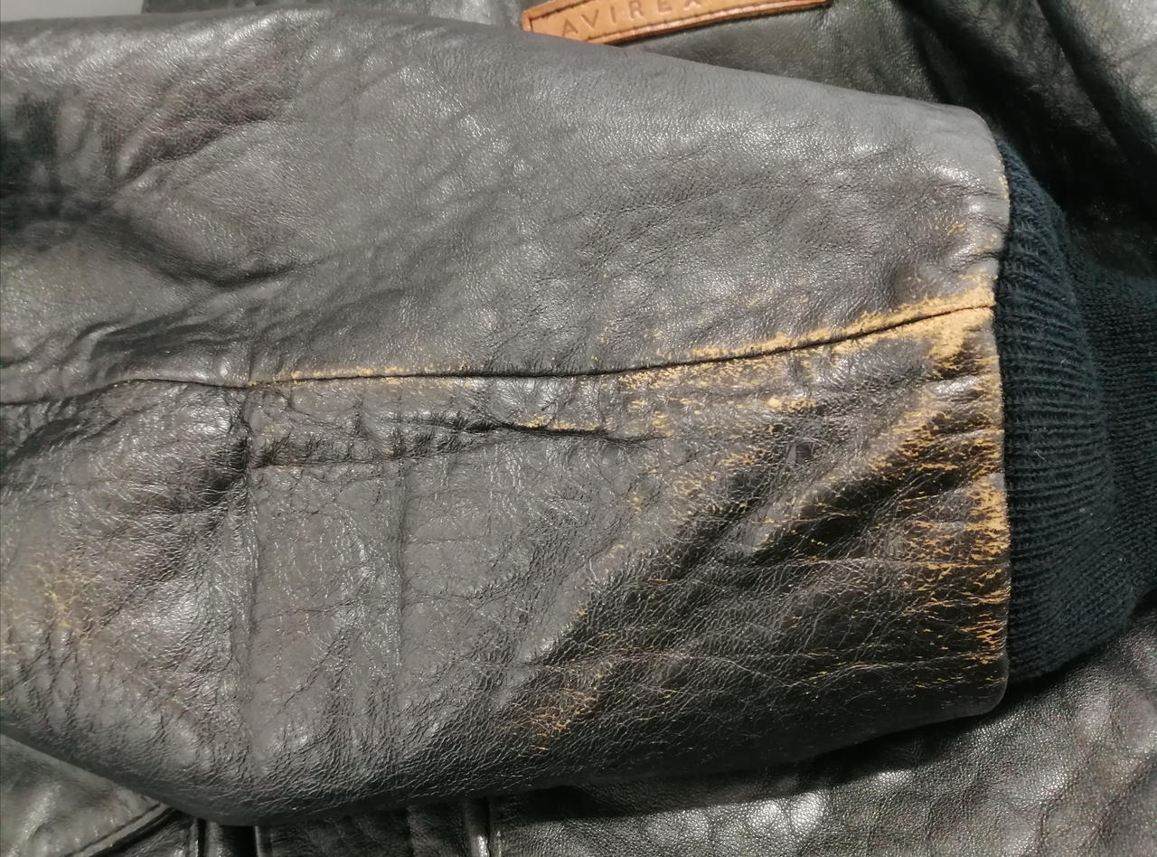 右手首剥がれあります