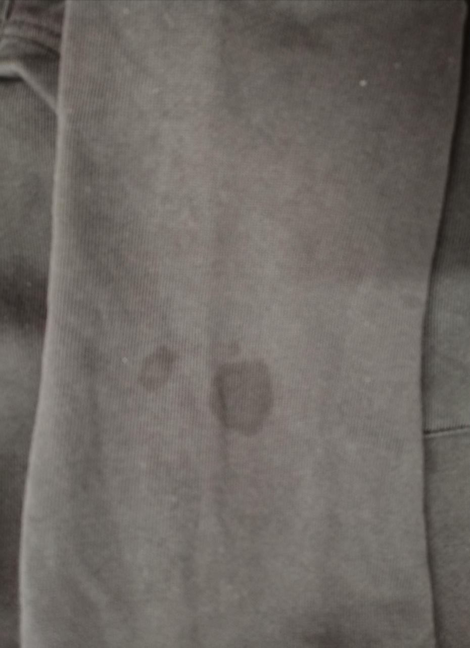 左手首汚れあります