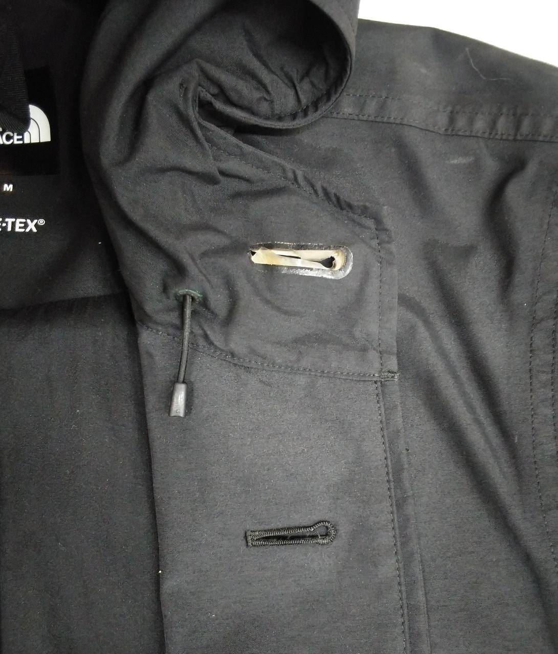 第一ボタンホール、ダメージあります