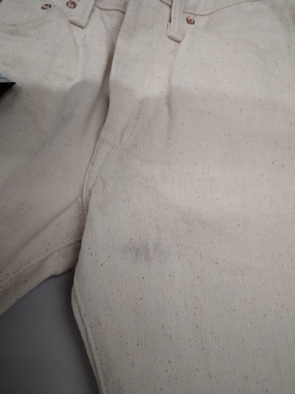 左足付け根付近、黒いシミあり