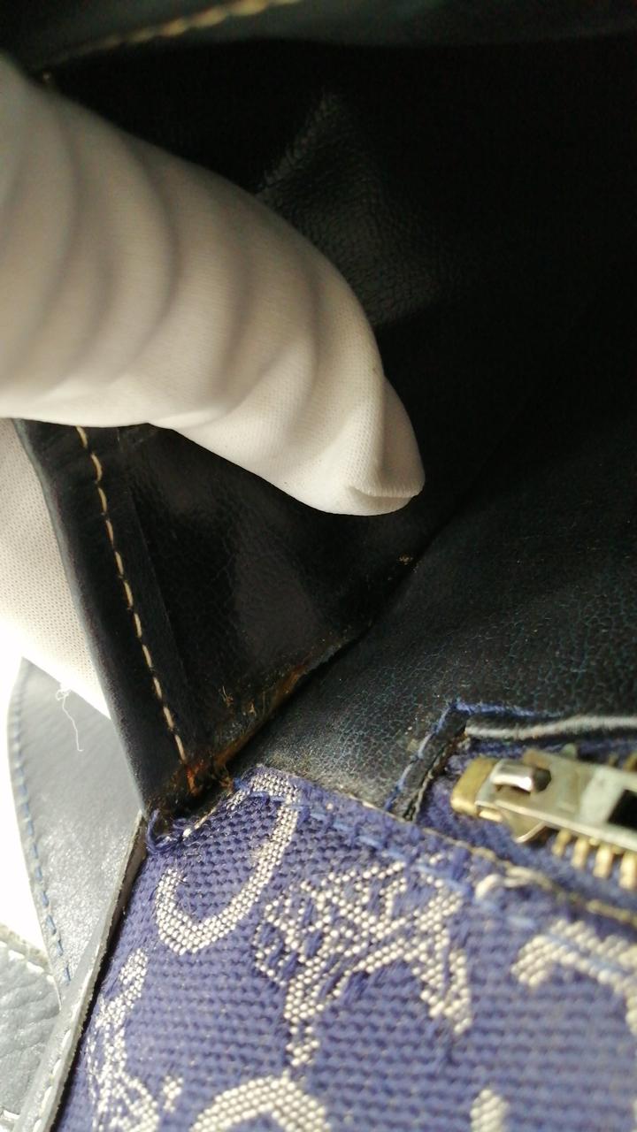 内側剥がれあり