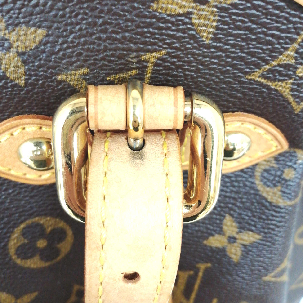 黒ずみ　4箇所あります。