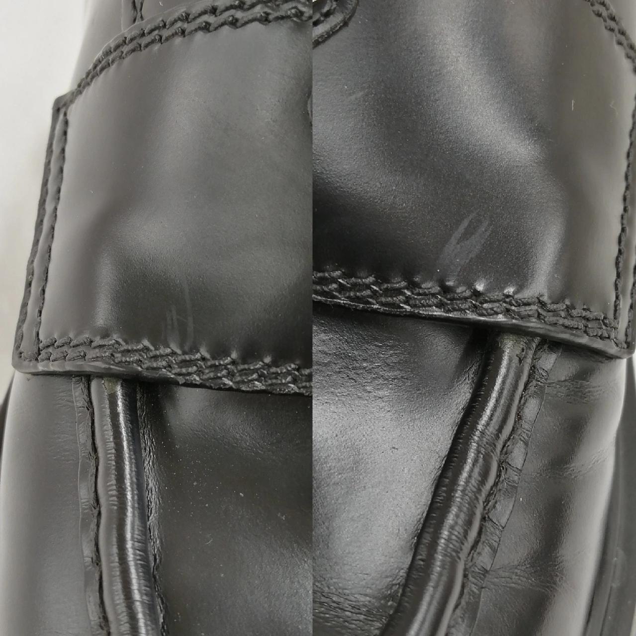 両足足の甲の外側あたりに剥がれあり