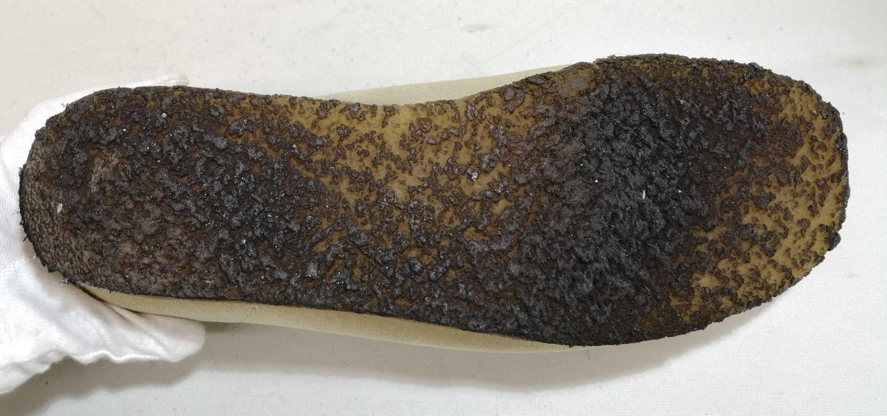 右足底面　汚れあり