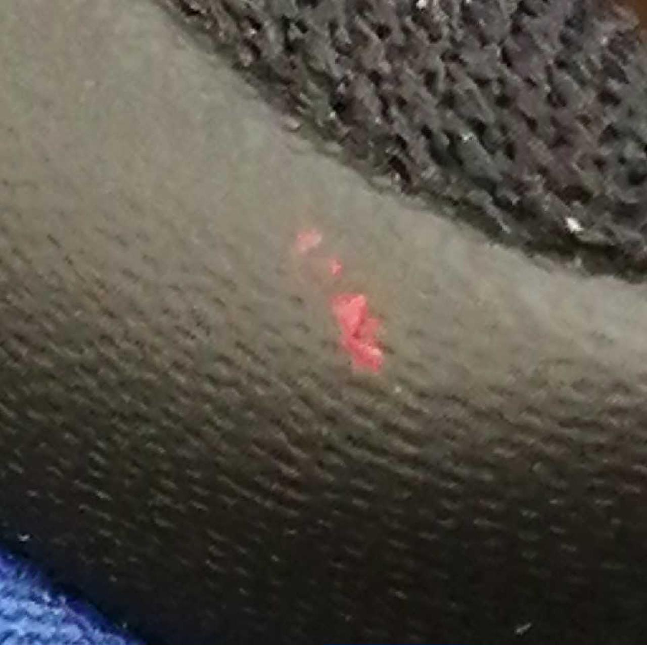 右足踵部分赤の汚れあり。