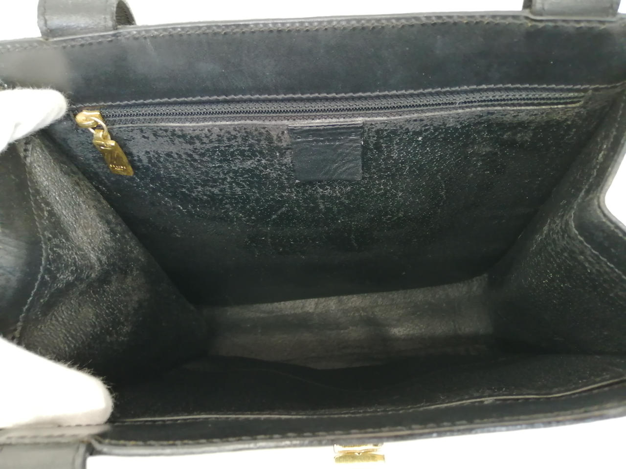 内側剥がれあり