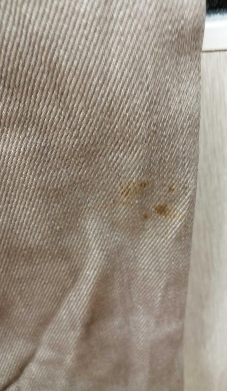 右足脛内側あたりシミあり