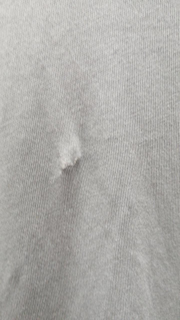 左胸 ダメージあり