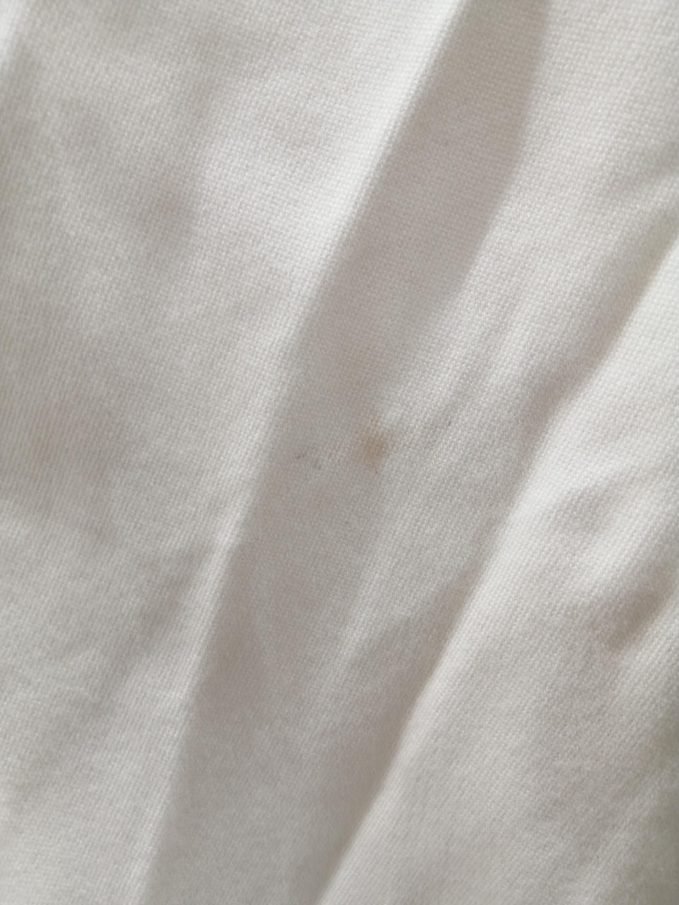 汚れ部分、拡大写真