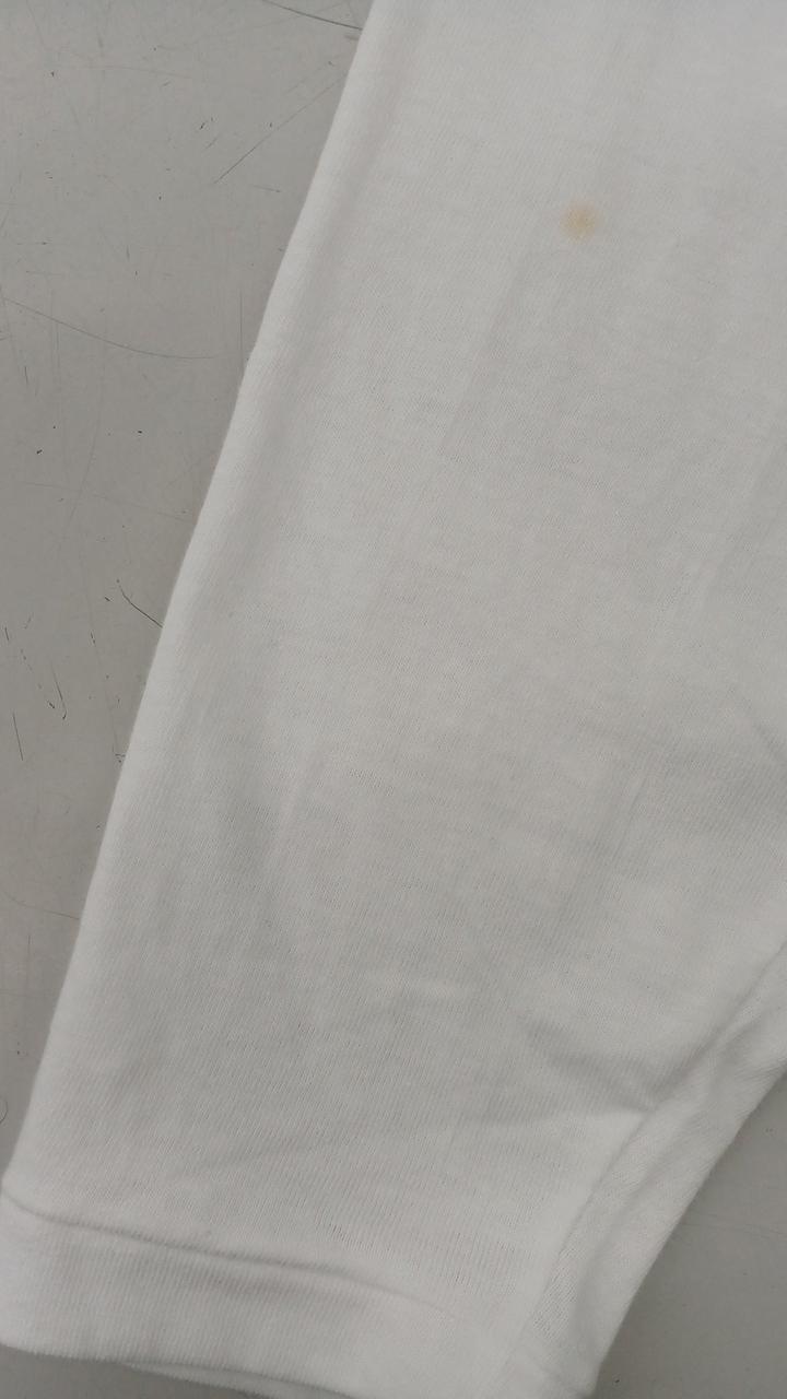 右腕前面