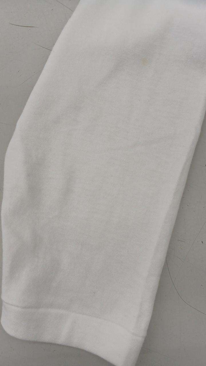 右腕背面