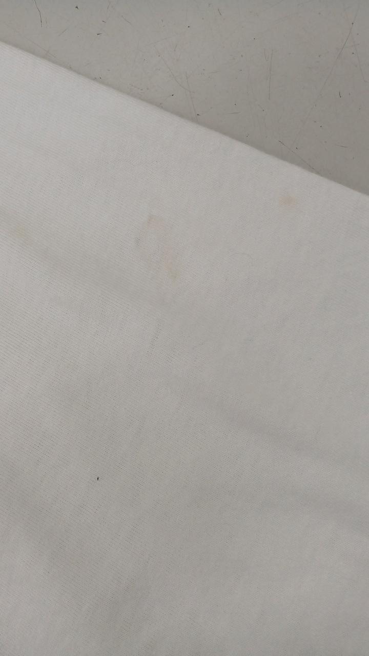 左腕前面