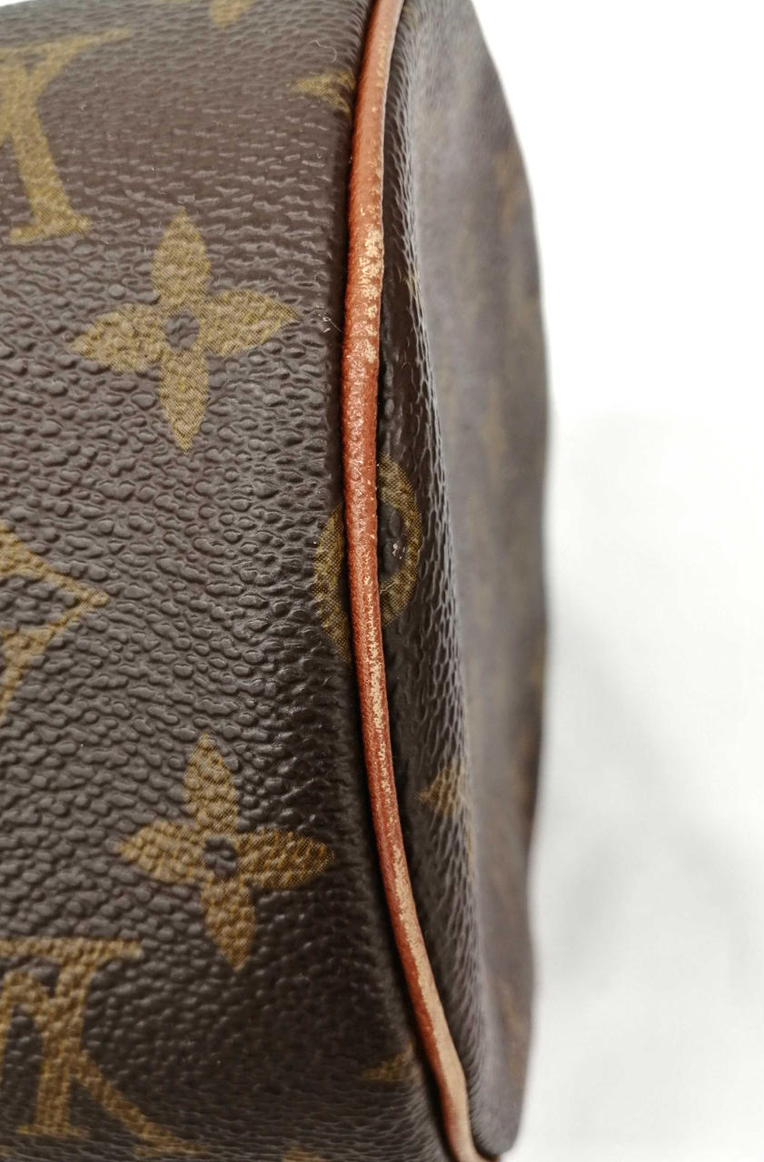 傷があります。