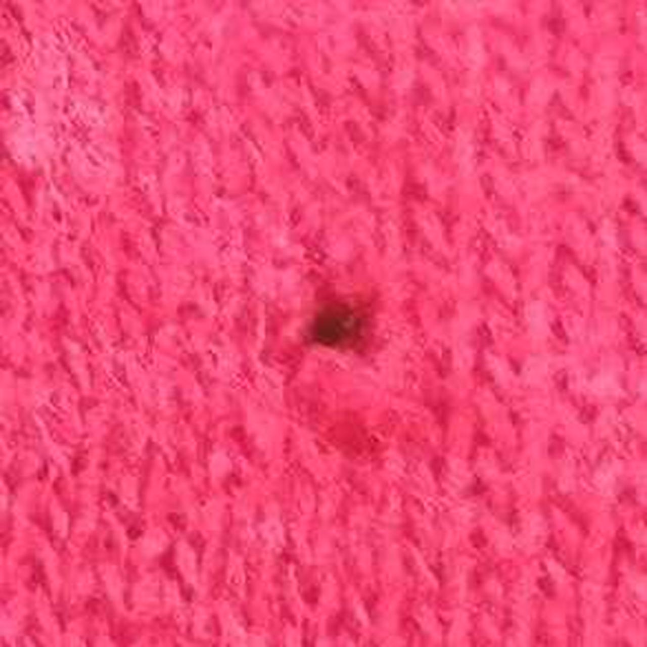 腹部に微小の穴あり