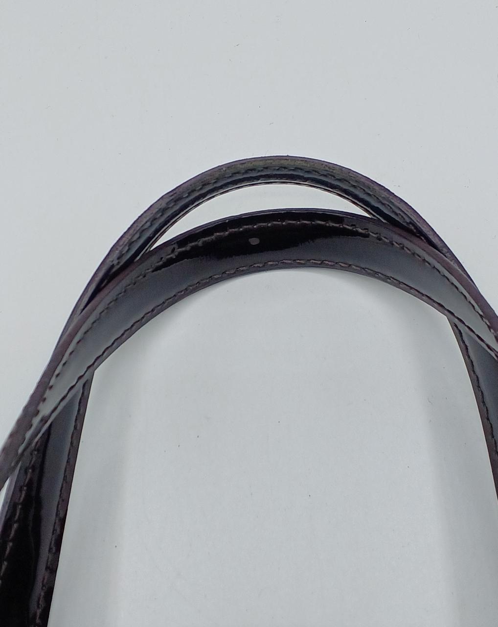 エナメルの剥がれあり