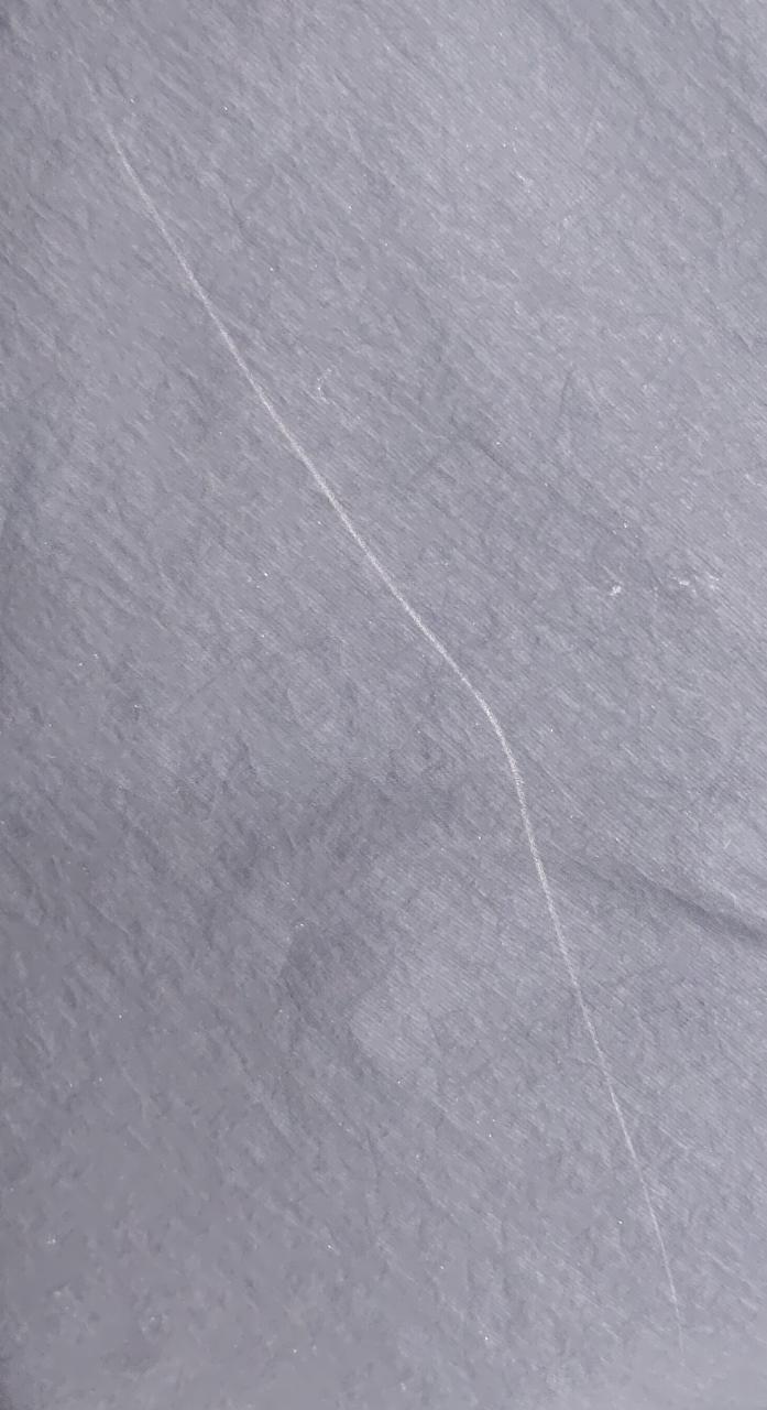 擦り傷あります。