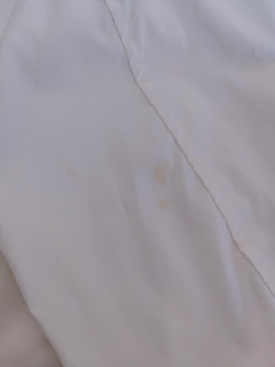 右肘シミ有ります