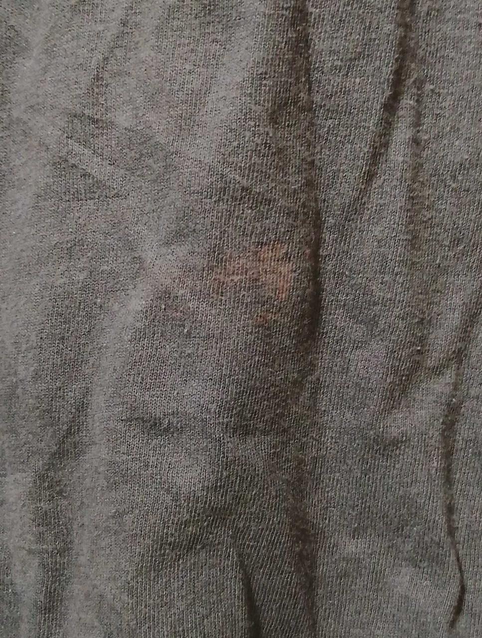 フロント汚れ有