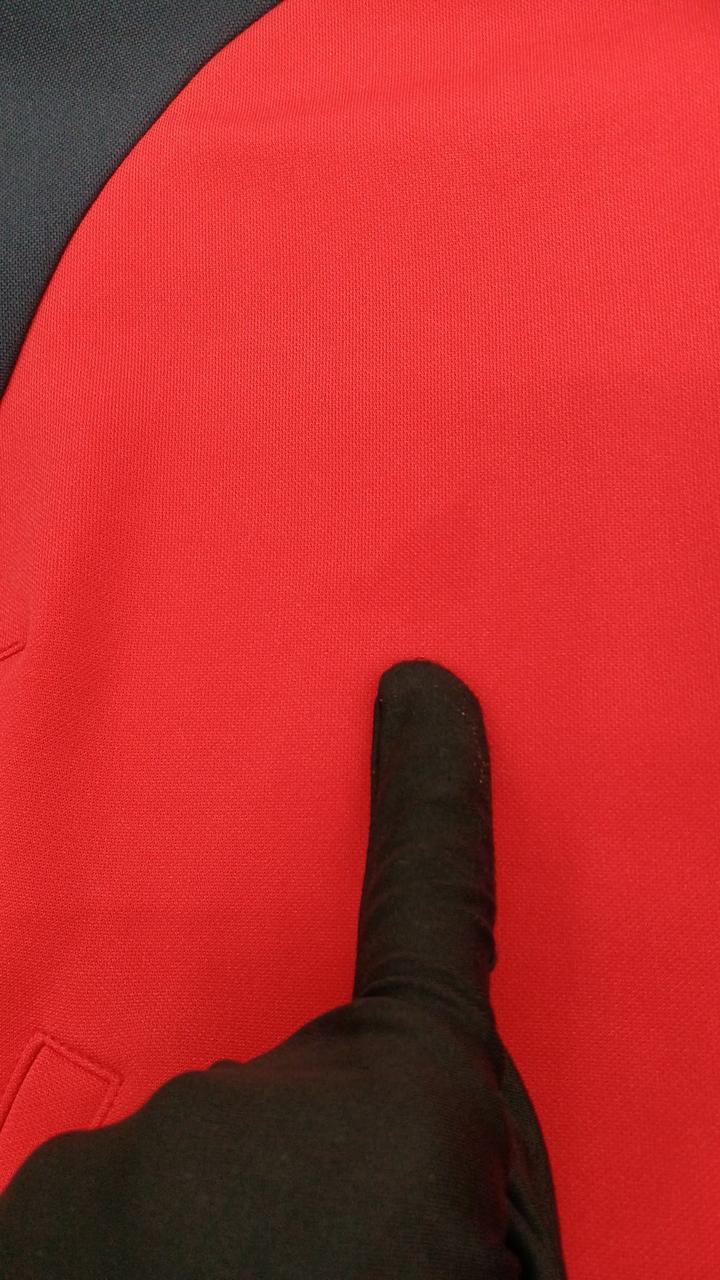 右胸部分にしみございます
