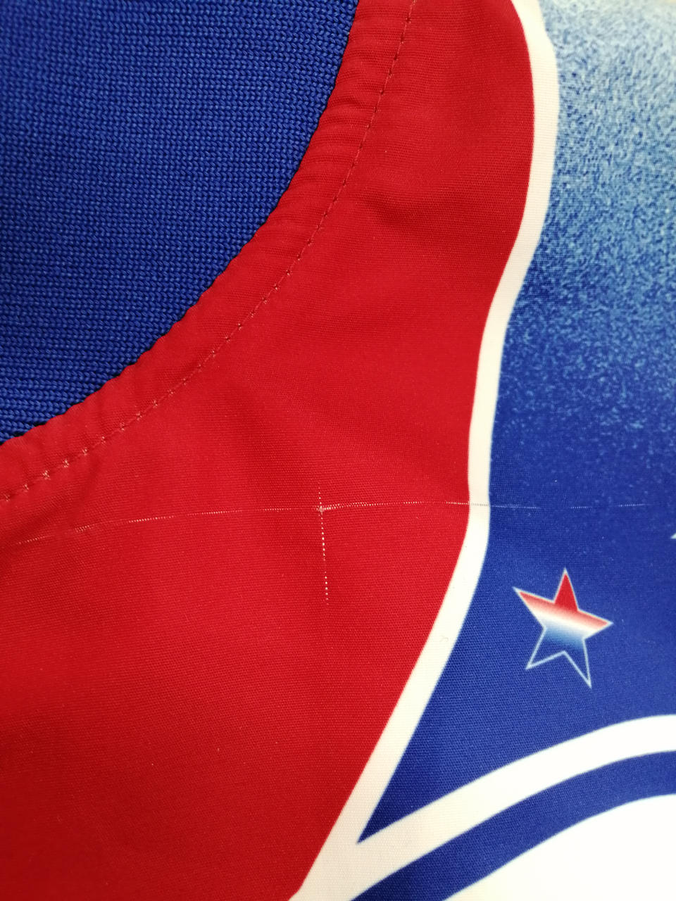 引きつれあり。