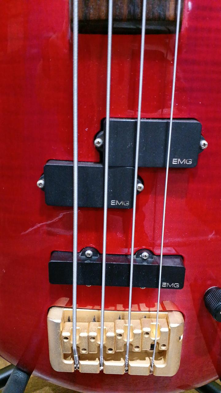 EMG