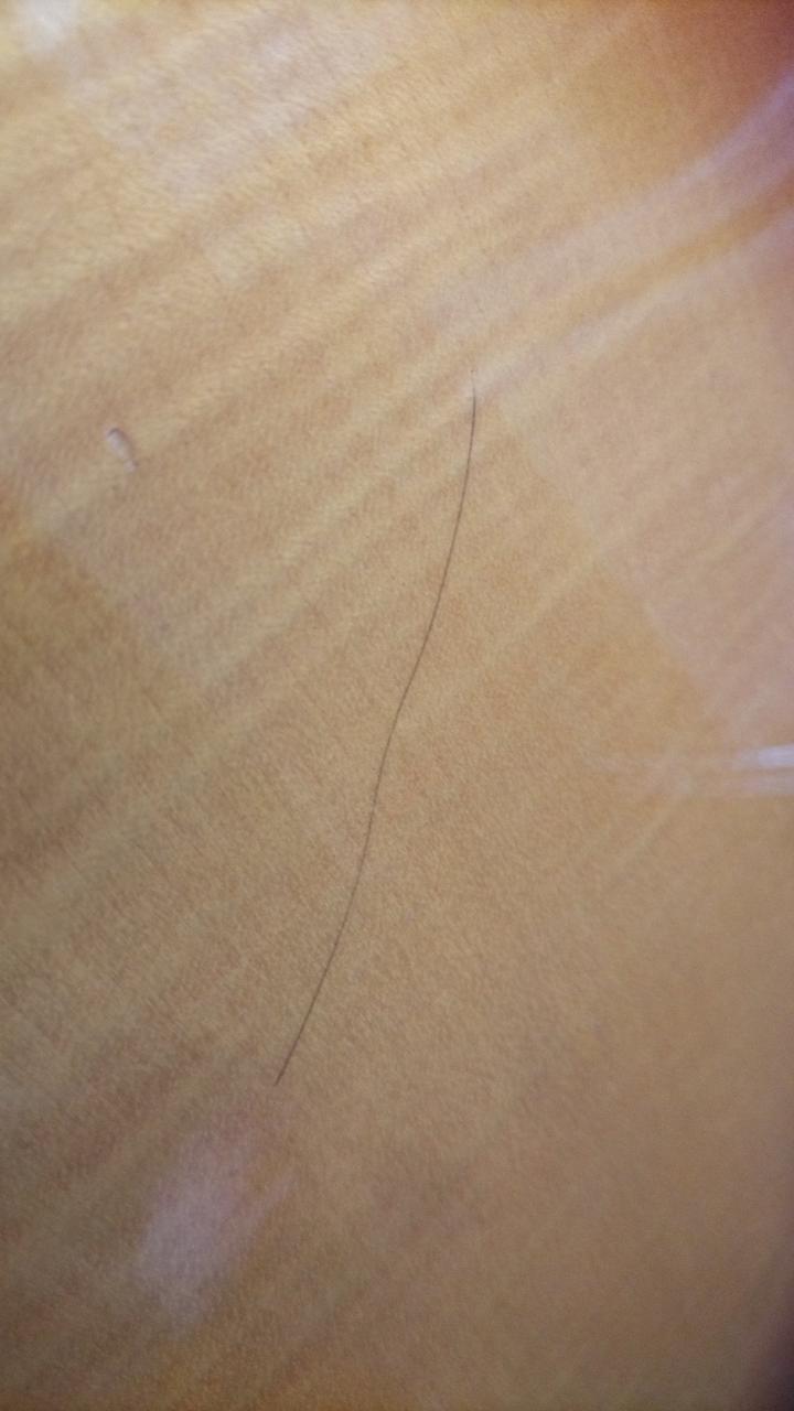 髪の毛ではなくキズっぽいです