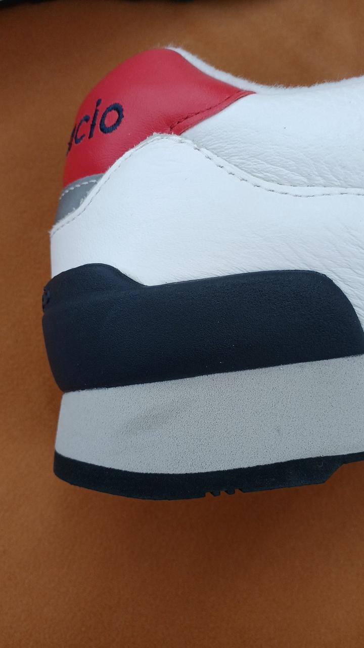 右足かかとに汚れあり