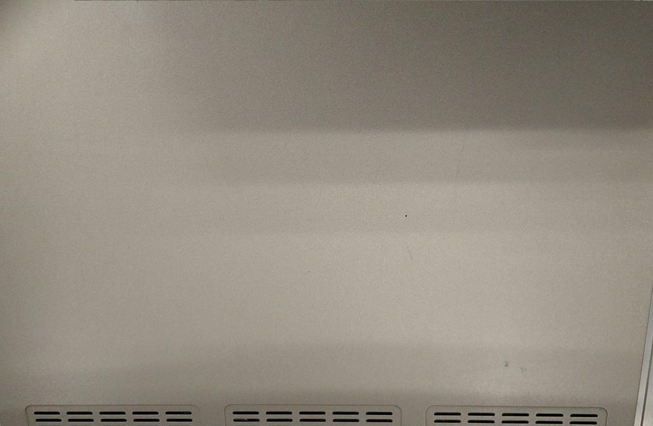 擦り傷多数あり