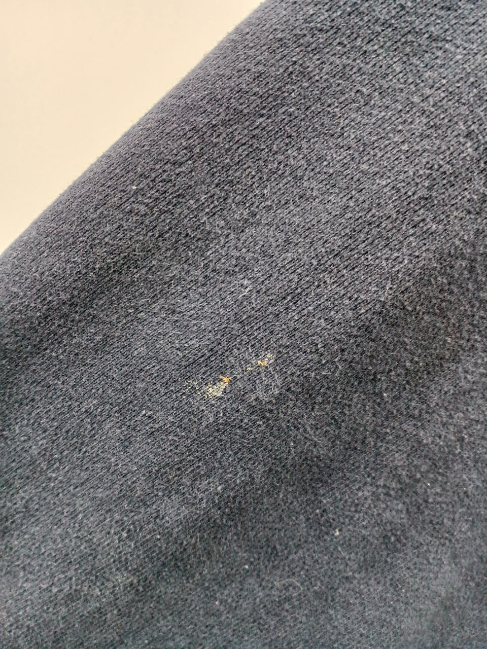 右腕前面　汚れあり