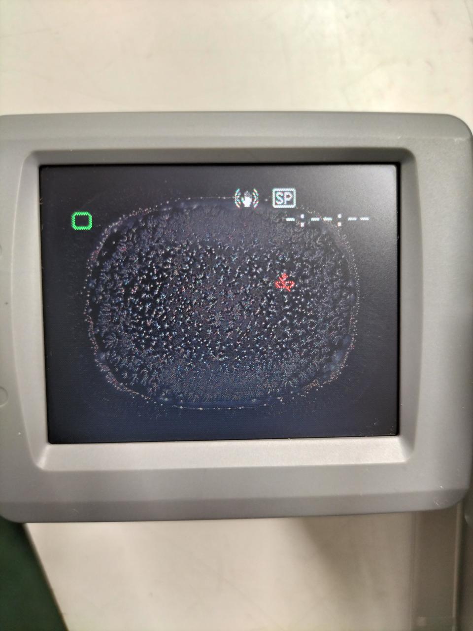 液晶画面にカビあり