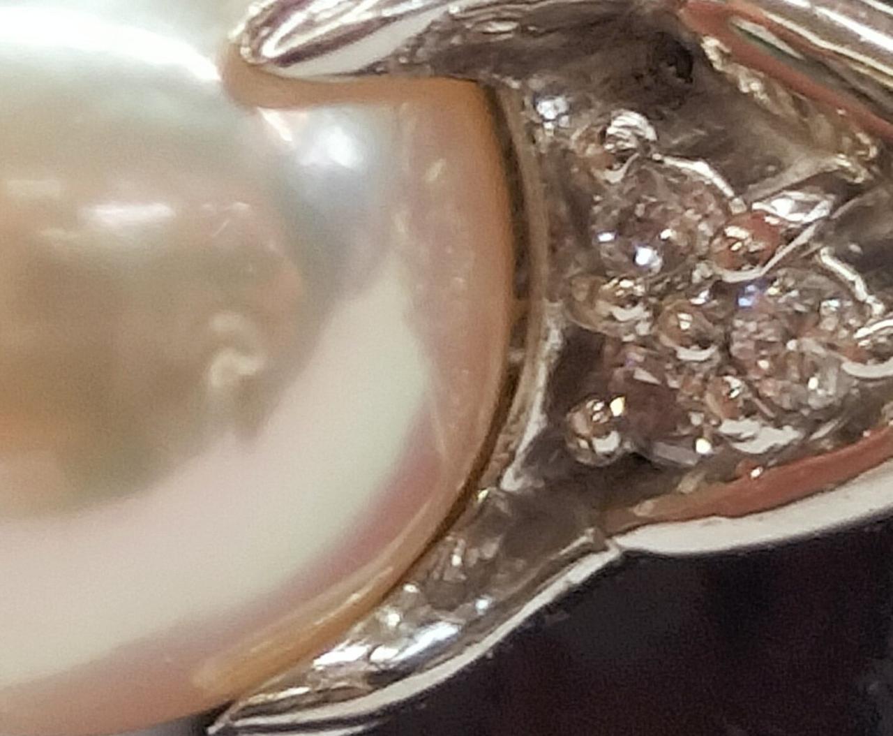 分かりづらいですが、えくぼ  です