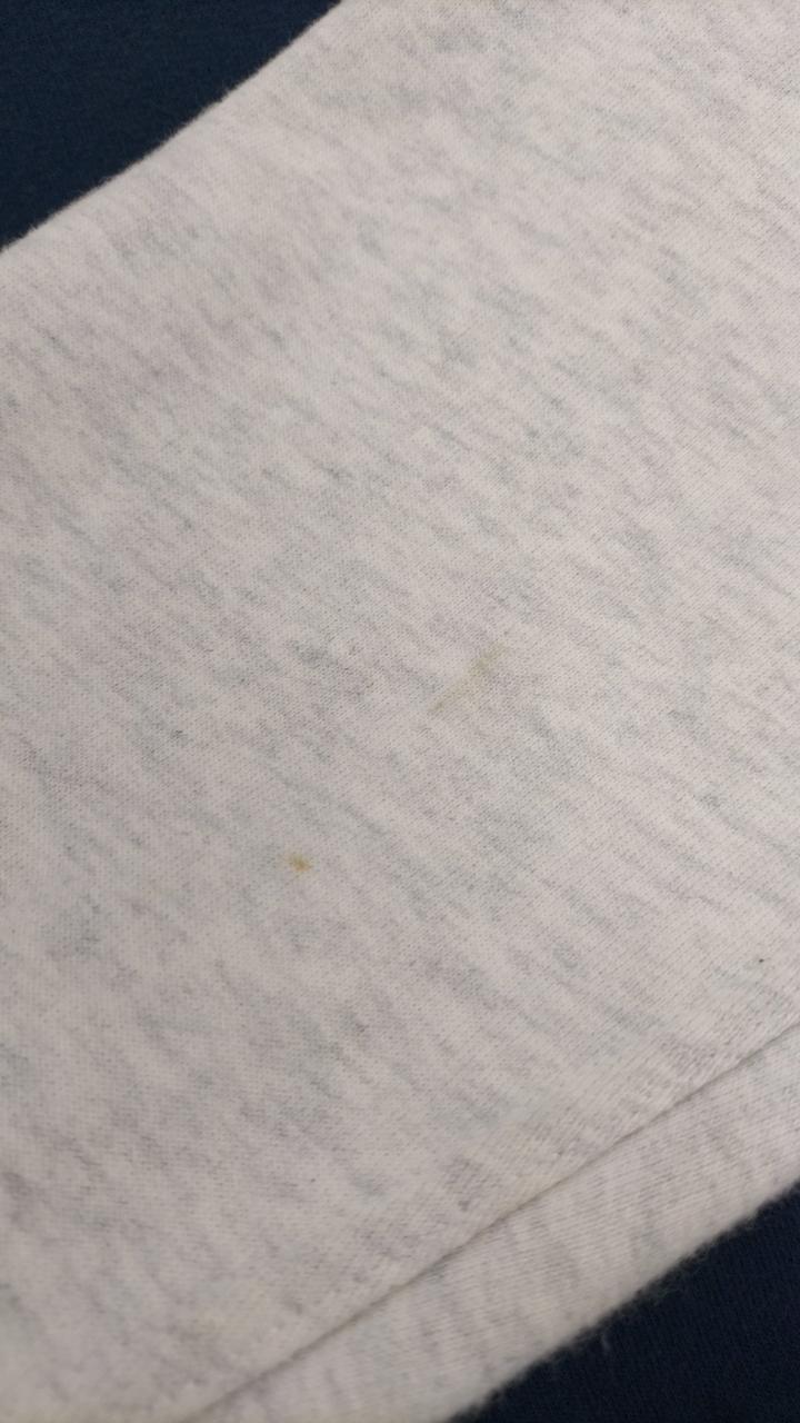 シミあります
