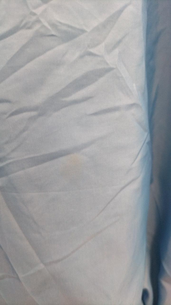 後ろ側シミあります