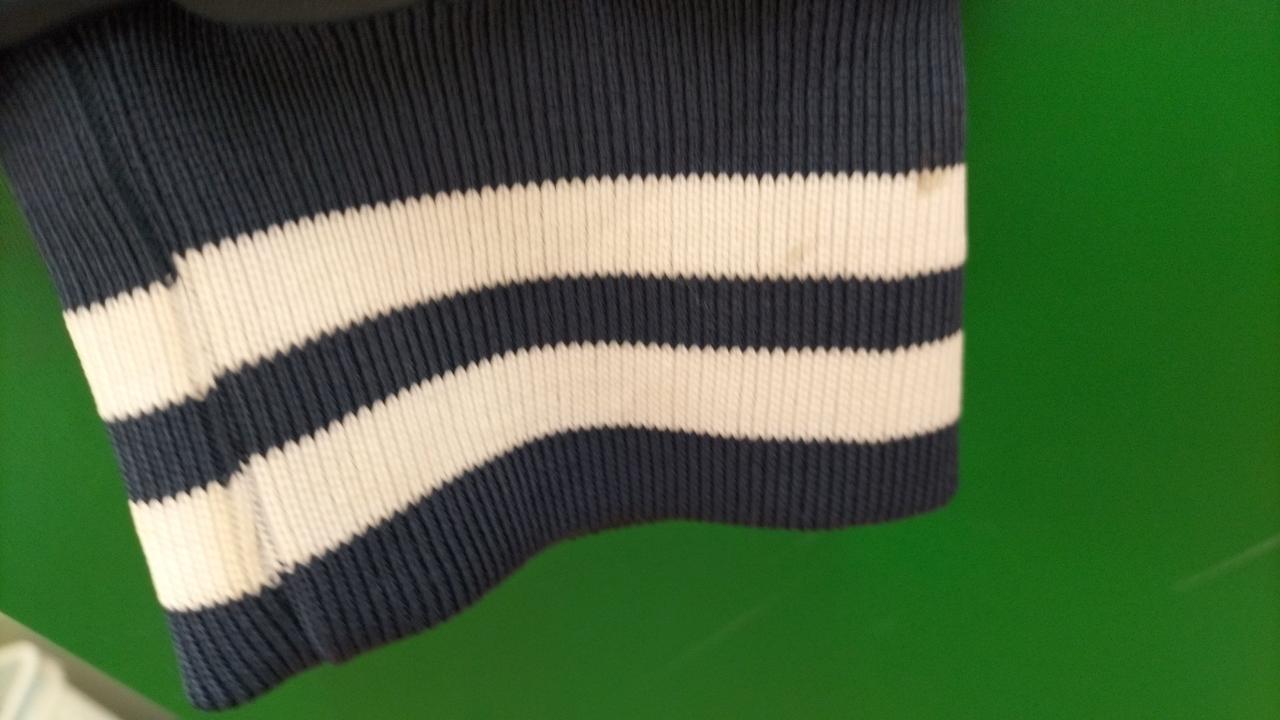 手首部分にシミあります