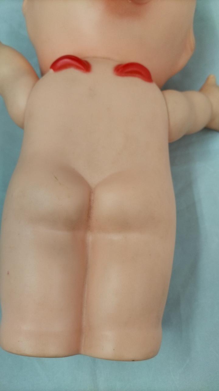 黒ずみ部分あります