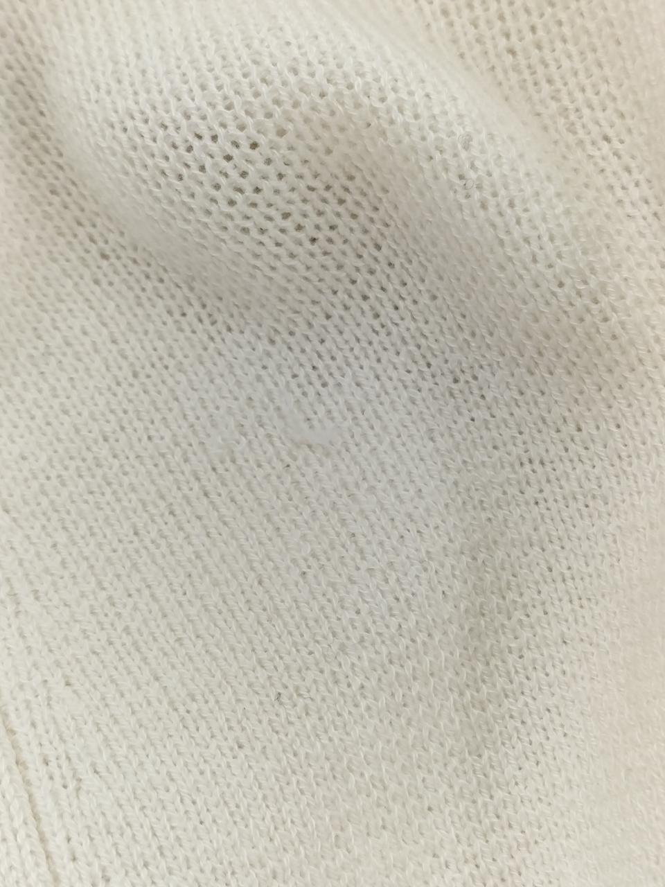 左肘後に糸つれあります。