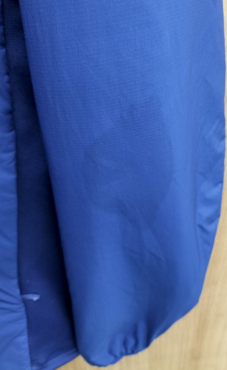 左腕に染み汚れあります