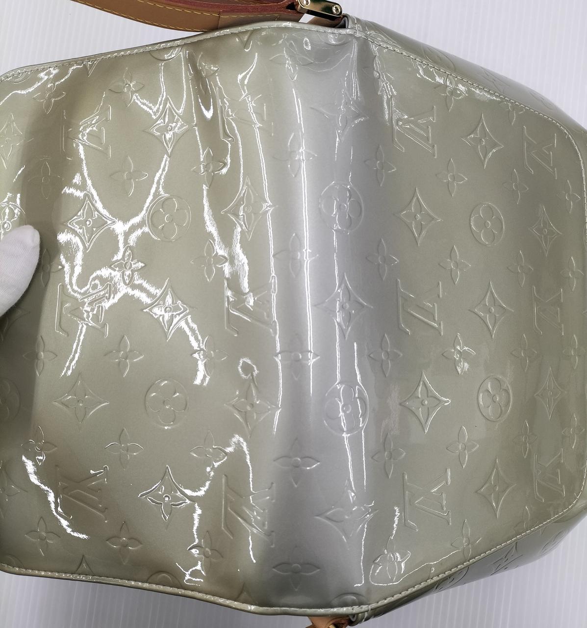 全体的に日焼けしております。