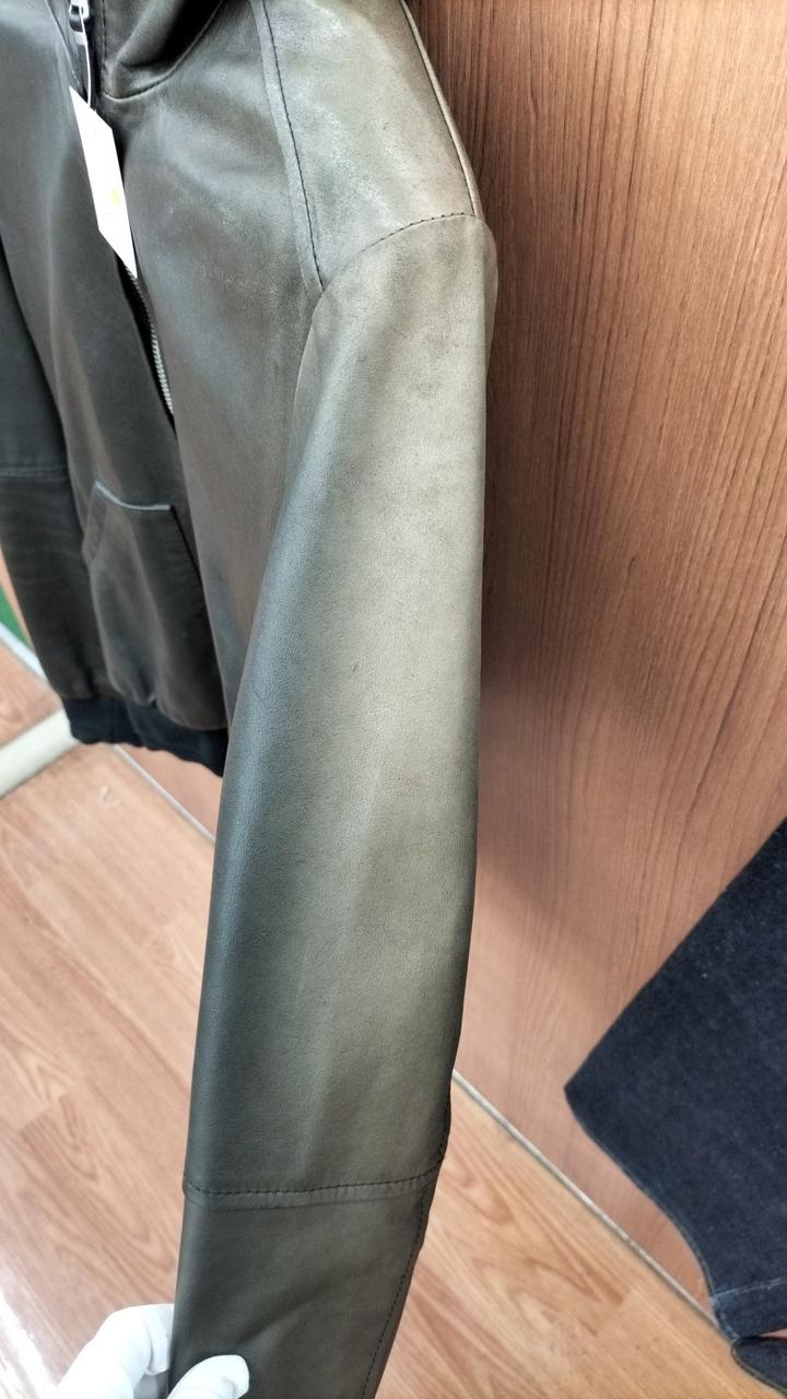 日焼けが目立ちます