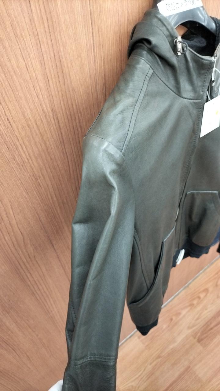 日焼けが目立ちます